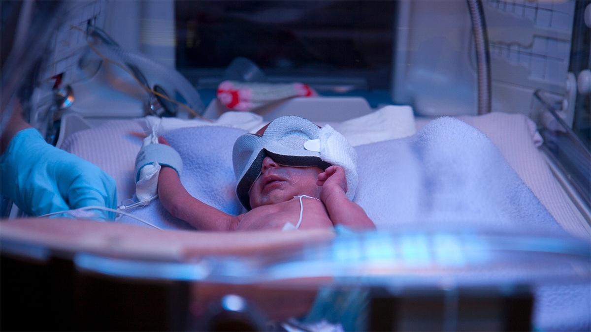 Breastfeeding for Preterm Babies: A Guide for Parents