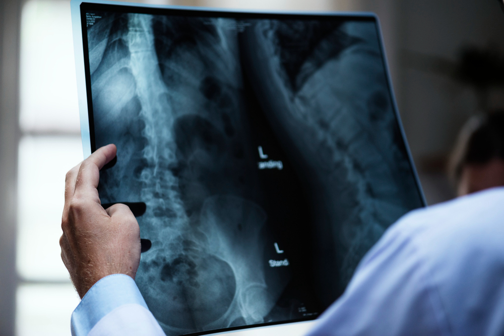 spine X-ray imaging scan orthopaedic