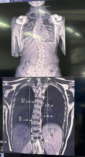 doctor reviewing patient spine scans pre-operative planning