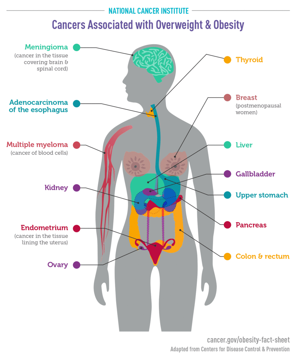 Cancers associated with overweight and obesity infographic