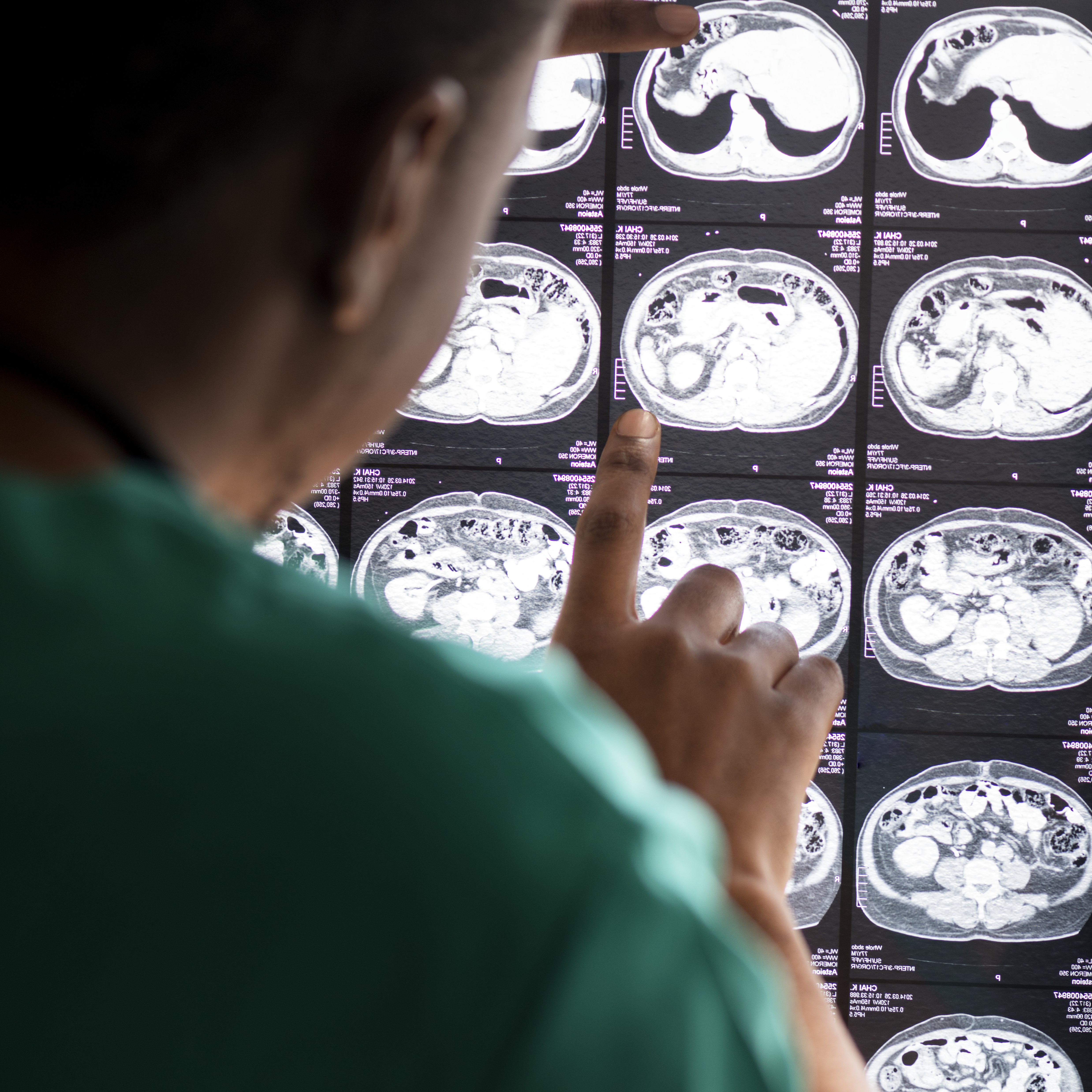 doctor reading brain MRI result