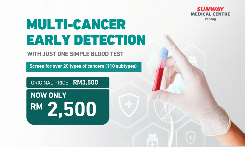 Multi-cancer Early Detection Screening